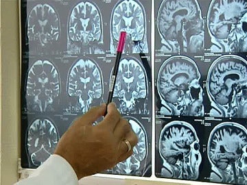 Radiografías del cerebro