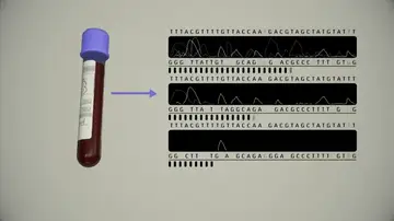 Un test de sangre podría permitir la detección temprana de ocho tipos comunes de cáncer